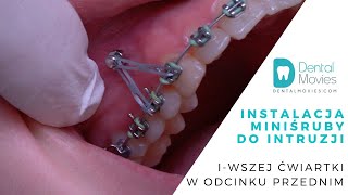 wides.pl 6FiWpVSleFk 