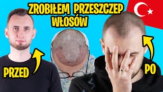 wides.pl 7t1hWZasiyg 