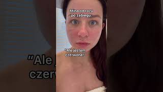 wides.pl SCZgx_efbNQ 